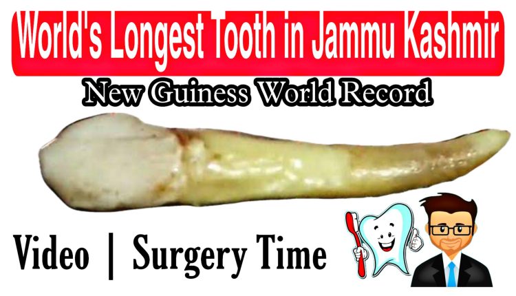 Worlds longest tooth in beerwah budgam Kashmir video news guiness book of world records